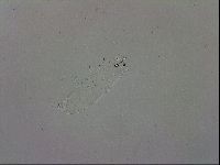 Mesobiotus orcadensis image