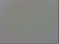 Mesobiotus orcadensis image