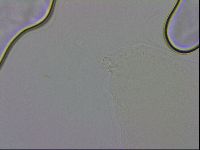 Mesobiotus orcadensis image