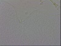 Media resource of Macrobiotus occidentalis