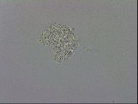 Mesobiotus orcadensis image