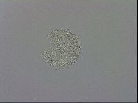 Mesobiotus orcadensis image