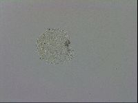 Mesobiotus orcadensis image