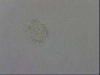 Mesobiotus orcadensis image
