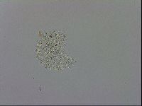 Mesobiotus orcadensis image