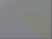 Mesobiotus orcadensis image