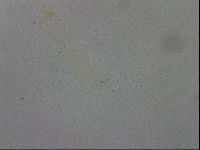 Mesobiotus orcadensis image
