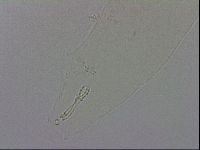 Mesobiotus orcadensis image