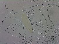 Mesobiotus orcadensis image