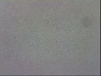 Mesobiotus orcadensis image