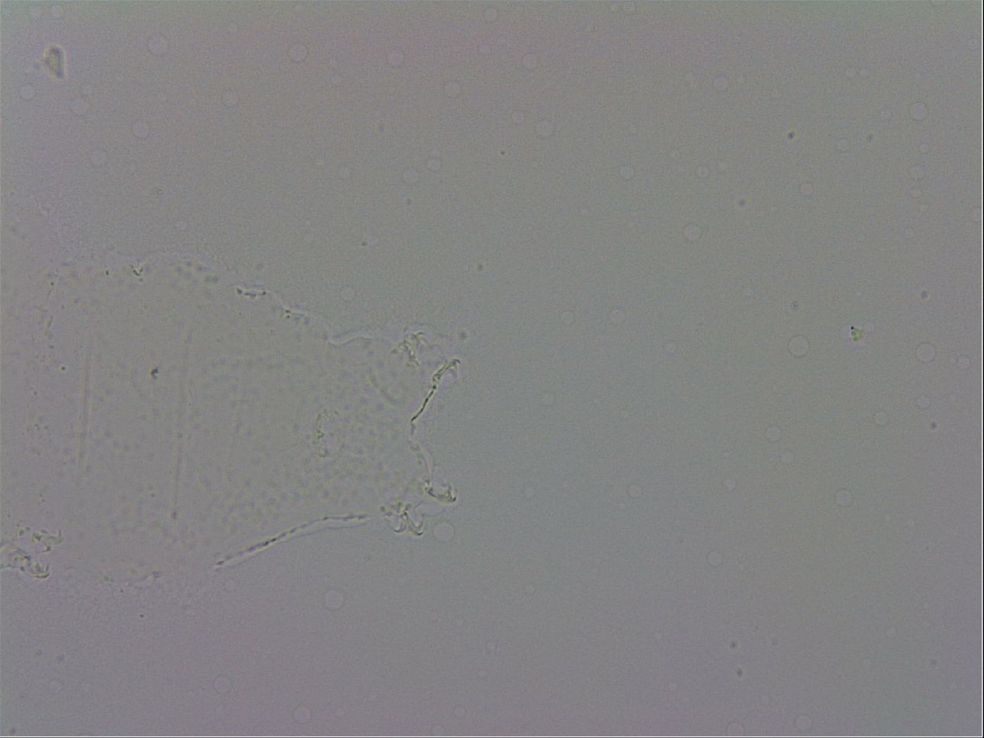Mesobiotus orcadensis image