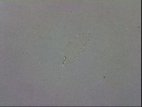 Mesobiotus orcadensis image