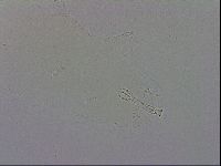 Mesobiotus orcadensis image