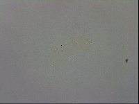 Mesobiotus orcadensis image