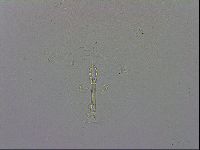 Mesobiotus orcadensis image