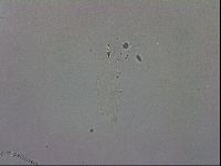 Mesobiotus orcadensis image