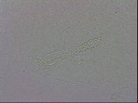 Mesobiotus orcadensis image
