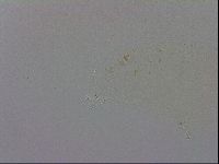 Mesobiotus orcadensis image