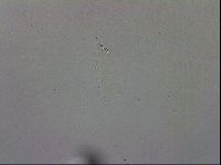 Mesobiotus orcadensis image