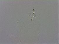 Mesobiotus orcadensis image