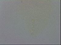 Mesobiotus orcadensis image
