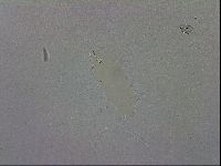 Mesobiotus orcadensis image