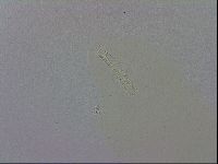 Mesobiotus orcadensis image