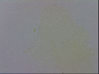 Mesobiotus polaris image