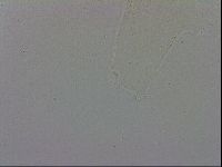 Mesobiotus polaris image