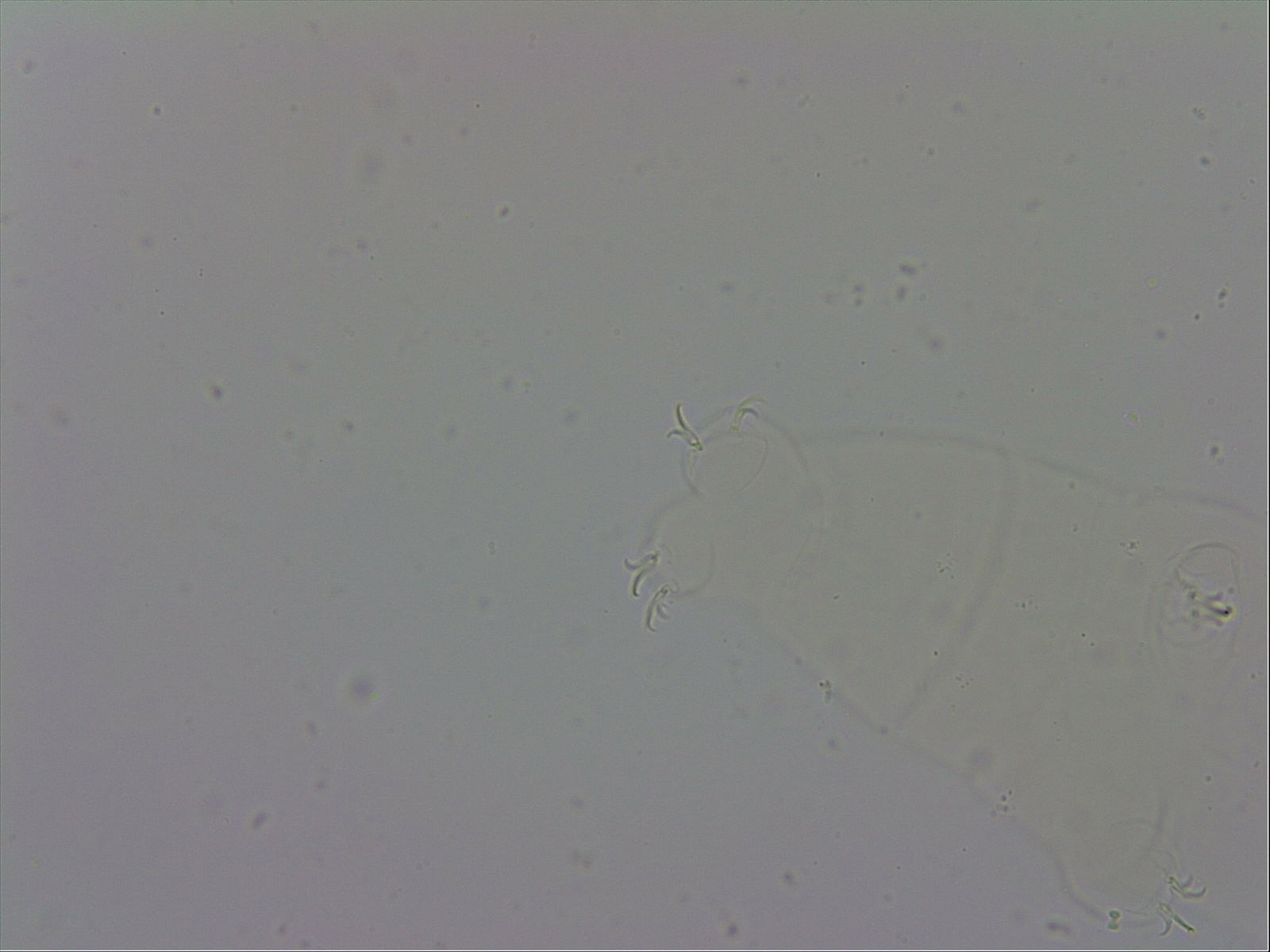 Mesobiotus polaris image