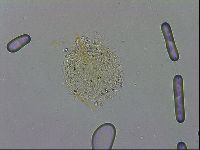 Mesobiotus polaris image