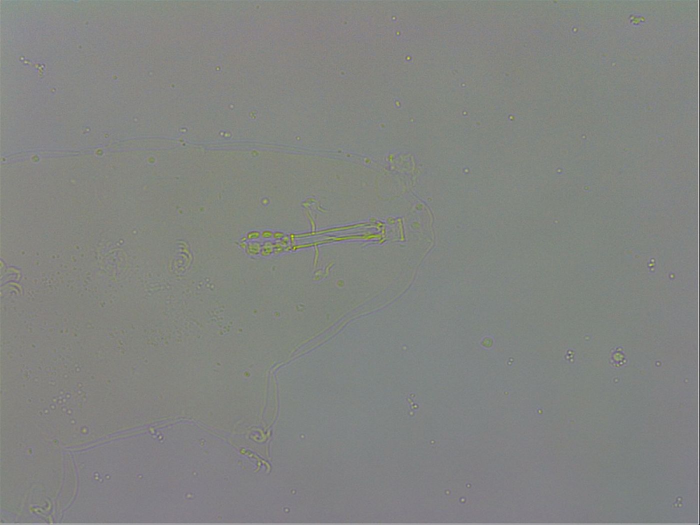 Mesobiotus polaris image