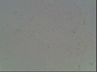 Macrobiotus recens image