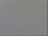 Media resource of Macrobiotus recens