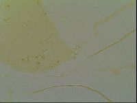 Macrobiotus islandicus image