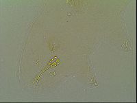Macrobiotus islandicus image