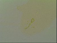 Macrobiotus islandicus image