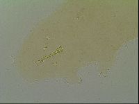 Macrobiotus islandicus image