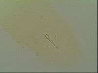 Macrobiotus islandicus image
