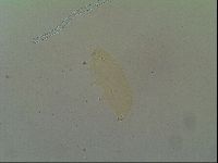 Macrobiotus islandicus image