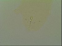 Macrobiotus islandicus image