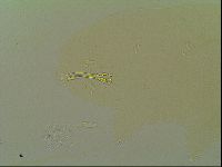 Macrobiotus islandicus image