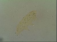 Macrobiotus islandicus image