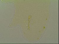 Macrobiotus islandicus image