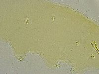 Macrobiotus islandicus image