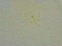Macrobiotus islandicus image