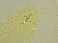Macrobiotus islandicus image
