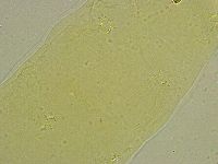 Macrobiotus islandicus image