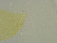 Macrobiotus islandicus image