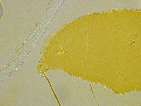 Macrobiotus islandicus image